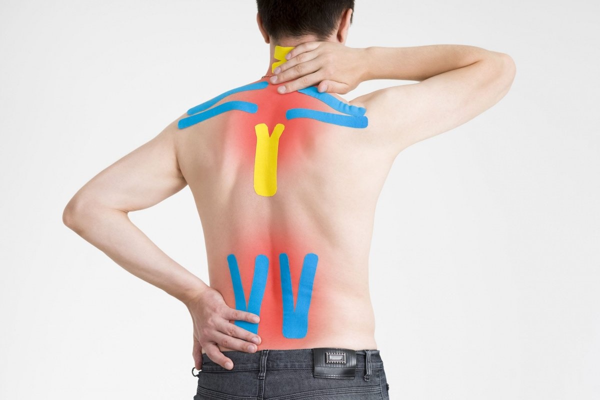 тейпирование поясницы при болях