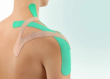 В чем заключаются особенности тейпирования плеча. Как правильно наложить кинезиотейпы на сустав при тендините.
